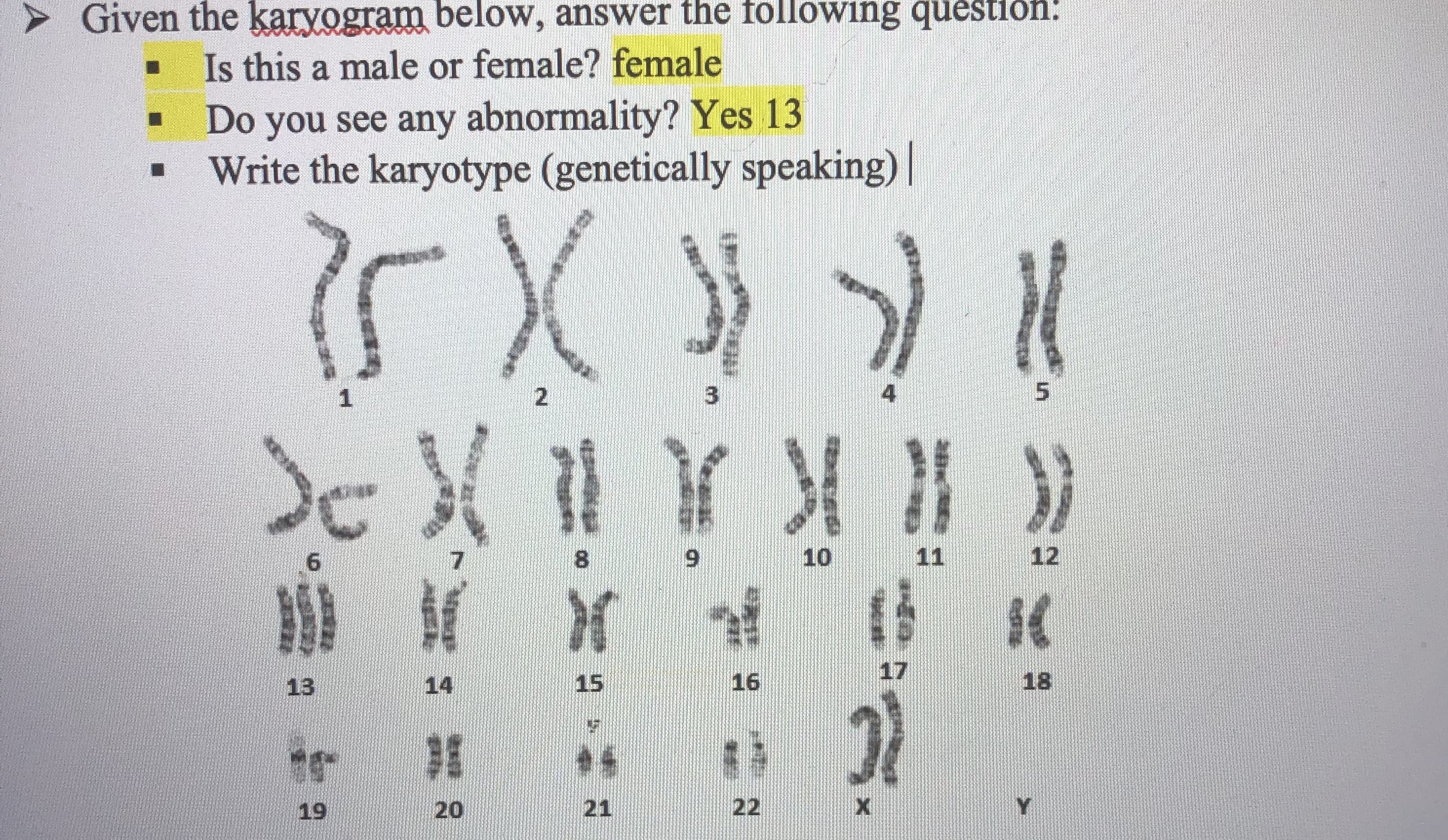 Given the karyogram below, anSW
Is this a male or female? female
Do you see any abnormality? Yes 13
Write the karyotype (genetically speaking)|
