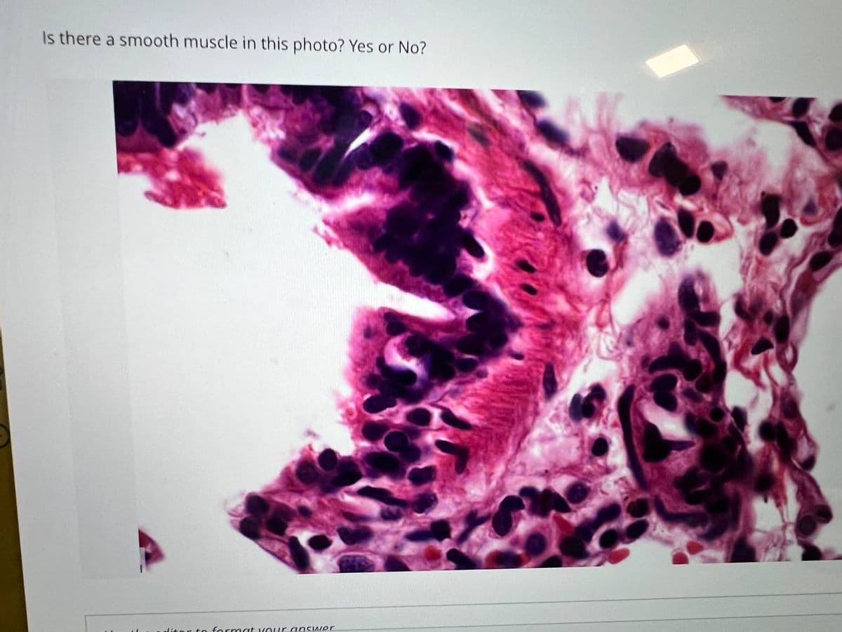 Is there a smooth muscle in this photo? Yes or No?
to format your answer