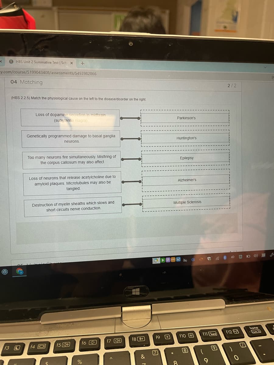 Seum
S HBS Unit 2 Summative Test | Sch x
y.com/course/5199043408/assessments/5493982866
04 Matching
2/2
(HBS 2.2.5) Match the physiological cause on the left to the disease/disorder on the right.
Loss of dopamine secretion in midbrain
(substantia niagra)
Parkinson's
Genetically programmed damage to basal ganglia
neurons.
Huntington's
Too many neurons fire simultaneously. Misfiring of
the corpus callosum may also affect
Epilepsy
Loss of neurons that release acetylcholine due to
amyloid plaques. Microtubules may also be
Alzheimer's
tangled.
Destruction of myelin sheaths which slows and
short circuits nerve conduction.
Multiple Sclerosis
home
f11
F12
f8 0
f9 O
f10 3
f6
f3 C
f4 O
8
&
