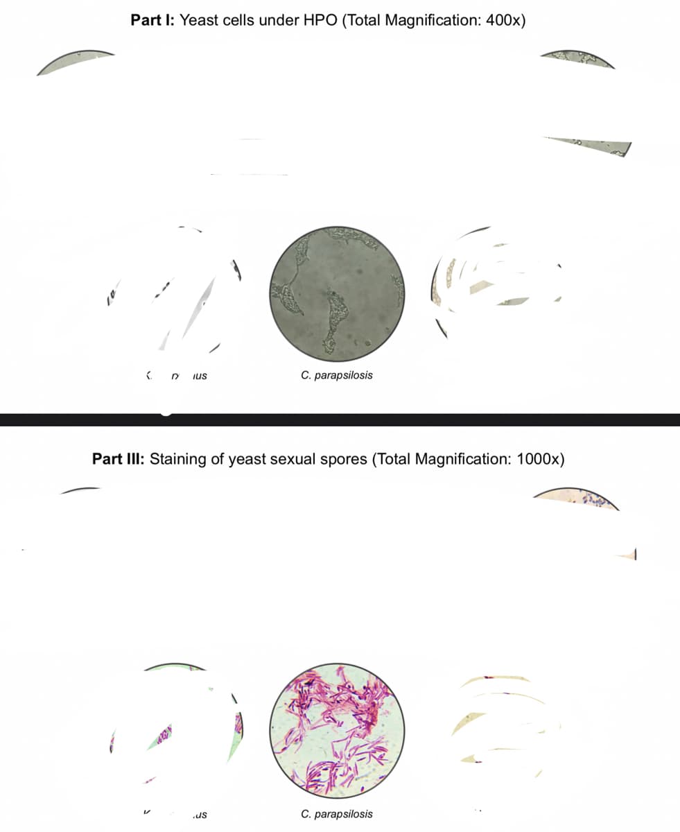 Part I: Yeast cells under HPO (Total Magnification: 400x)
<DY IUS
C. parapsilosis
Part III: Staining of yeast sexual spores (Total Magnification: 1000x)
.us
C. parapsilosis