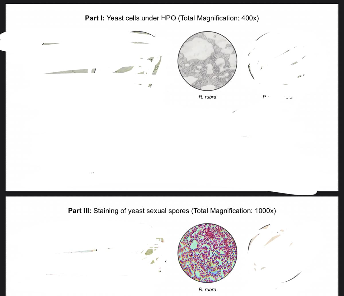 Part I: Yeast cells under HPO (Total Magnification: 400x)
R. rubra
P
Part III: Staining of yeast sexual spores (Total Magnification: 1000x)
R. rubra