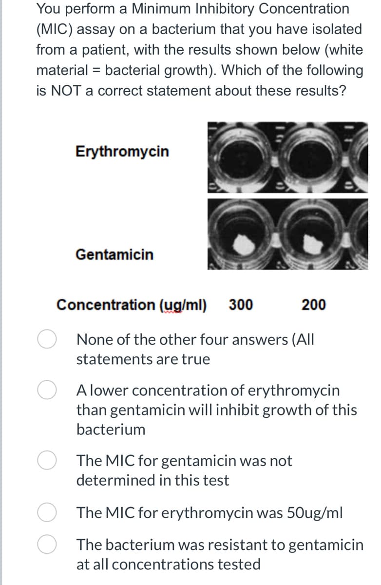You perform a Minimum Inhibitory Concentration
(MIC) assay on a bacterium that you have isolated
from a patient, with the results shown below (white
material = bacterial growth). Which of the following
is NOT a correct statement about these results?
Erythromycin
Gentamicin
Concentration (ug/ml) 300
None of the other four answers (All
statements are true
200
A lower concentration of erythromycin
than gentamicin will inhibit growth of this
bacterium
The MIC for gentamicin was not
determined in this test
The MIC for erythromycin was 50ug/ml
The bacterium was resistant to gentamicin
at all concentrations tested