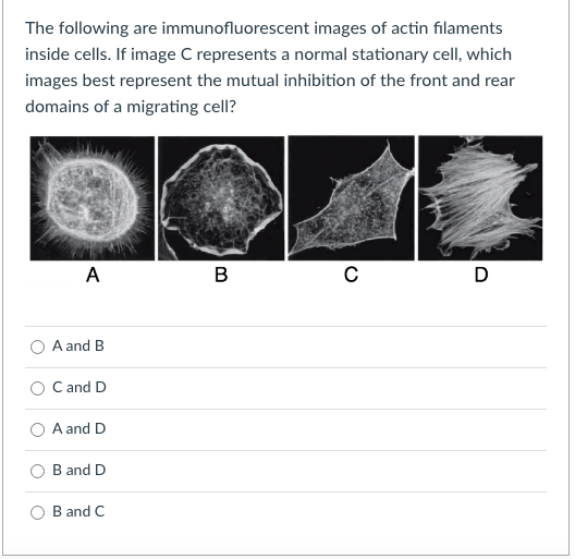 The following are immunofluorescent images of actin filaments
inside cells. If image C represents a normal stationary cell, which
images best represent the mutual inhibition of the front and rear
domains of a migrating cell?
A
в
D
A and B
C and D
A and D
B and D
B and C
