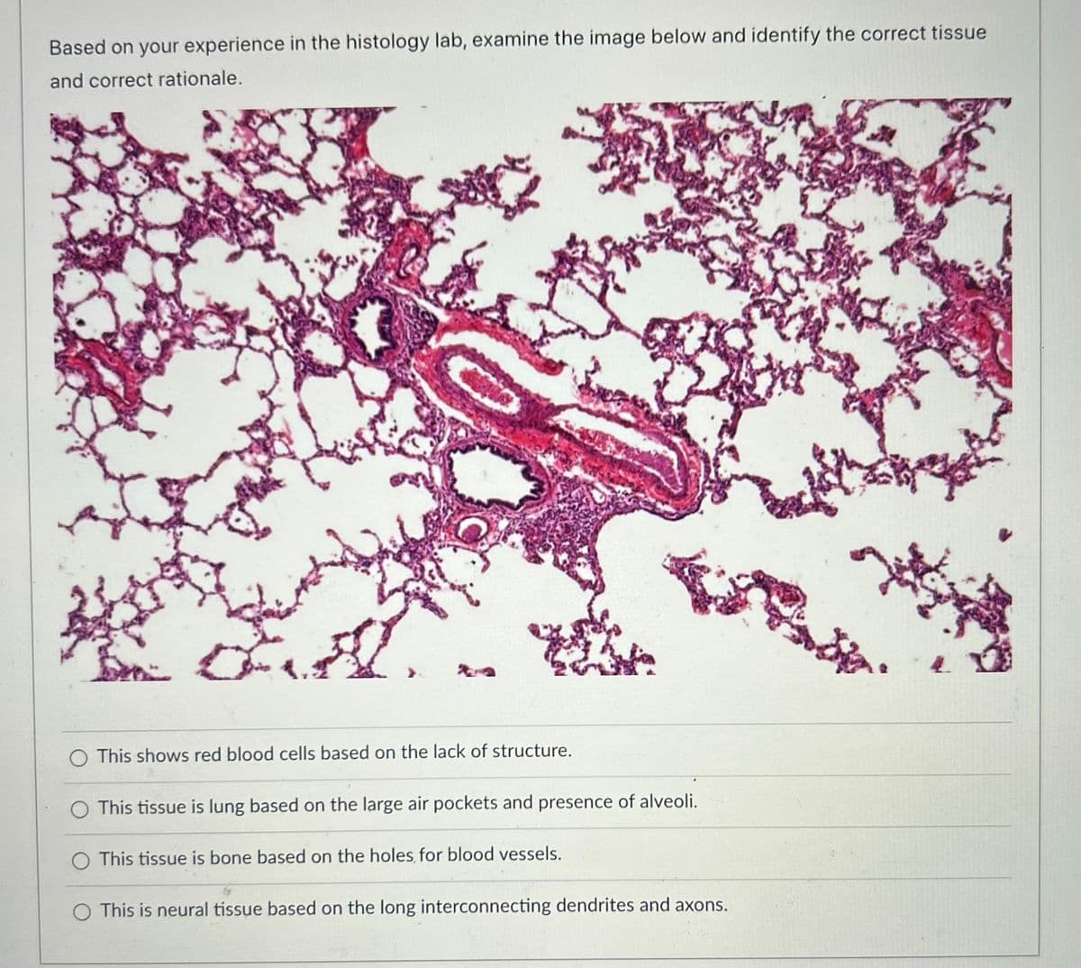 Based on your experience in the histology lab, examine the image below and identify the correct tissue
and correct rationale.
O This shows red blood cells based on the lack of structure.
O This tissue is lung based on the large air pockets and presence of alveoli.
This tissue is bone based on the holes for blood vessels.
O This is neural tissue based on the long interconnecting dendrites and axons.