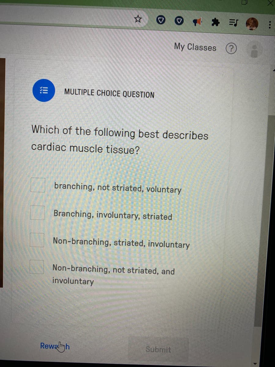 My Classes
MULTIPLE CHOICE QUESTION
Which of the following best describes
cardiac muscle tissue?
branching, not striated, voluntary
Branching, involuntary, striated
Non-branching, striated, involuntary
Non-branching, not striated, and
involuntary
Rewagh
Submit
!!
