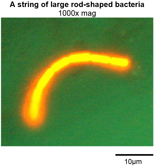 A string of large rod-shaped bacteria
1000x mag
10μm
