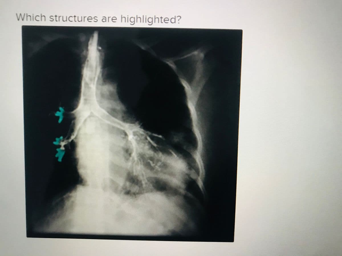 Which structures are highlighted?
