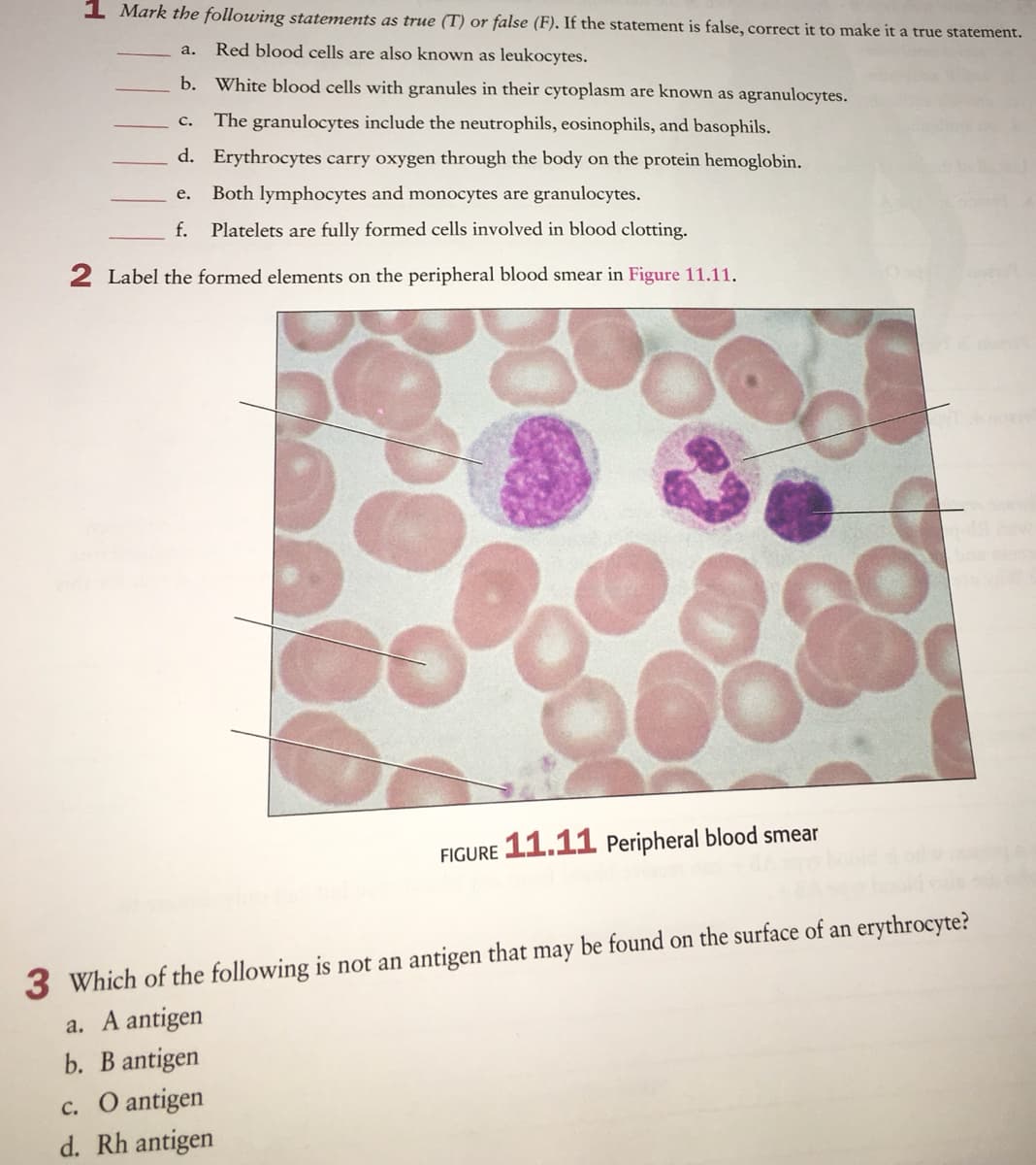 1 Mark the following statements as true (T) or false (F). If the statement is false, correct it to make it a true statement.
Red blood cells are also known as leukocytes.
a.
b. White blood cells with granules in their cytoplasm are known as agranulocytes.
The granulocytes include the neutrophils, eosinophils, and basophils.
с.
d. Erythrocytes carry oxygen through the body on the protein hemoglobin.
е.
Both lymphocytes and monocytes are granulocytes.
f.
Platelets are fully formed cells involved in blood clotting.
2 Label the formed elements on the peripheral blood smear in Figure 11.11.
FIGURE 11.11 Peripheral blood smear
3 Which of the following is not an antigen that may be found on the surface of an erythrocyte?
a. A antigen
b. B antigen
c. O antigen
d. Rh antigen
