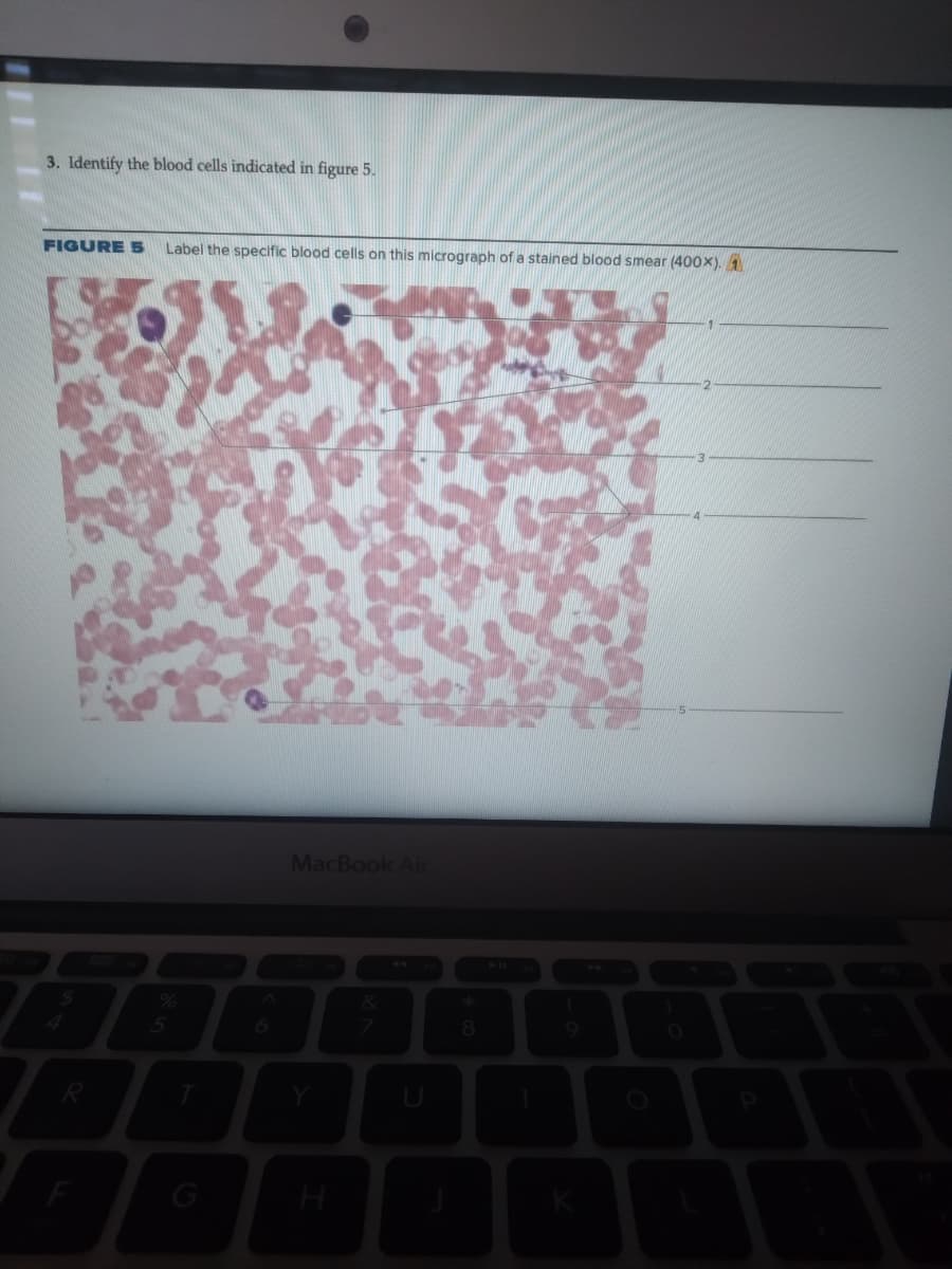 3. Identify the blood cells indicated in figure 5.
FIGURE 5
Label the specific blood cells on this micrograph of a stained blood smear (400X).
MacBook Air
8.
H
