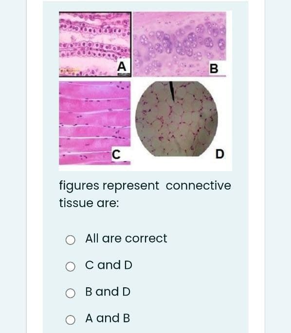 А
В
C
figures represent connective
tissue are:
All are correct
C and D
B and D
O A and B

