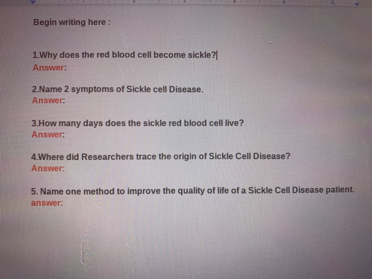 Begin writing here :
1.Why does the red blood cell become sickle?|
Answer:
2.Name 2 symptoms of Sickle cell Disease.
Answer:
3.How many days does the sickle red blood cell live?
Answer:
4.Where did Researchers trace the origin of Sickle Cell Disease?
Answer:
5. Name one method to improve the quality of life of a Sickle Cell Disease patient.
answer:
