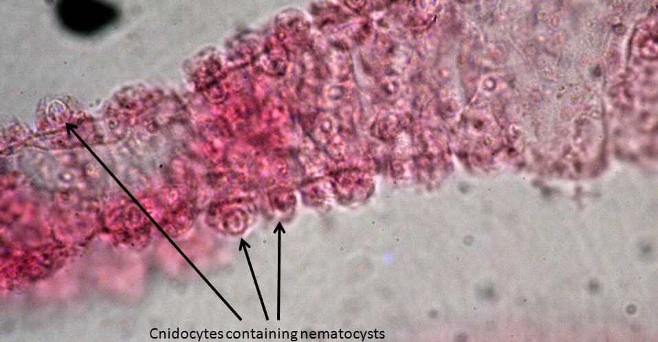 Cnidocytes containing nematocysts
