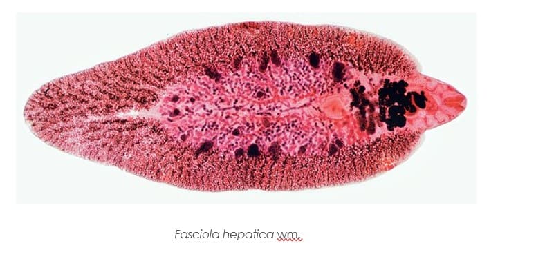 Fasciola hepatica wm.
