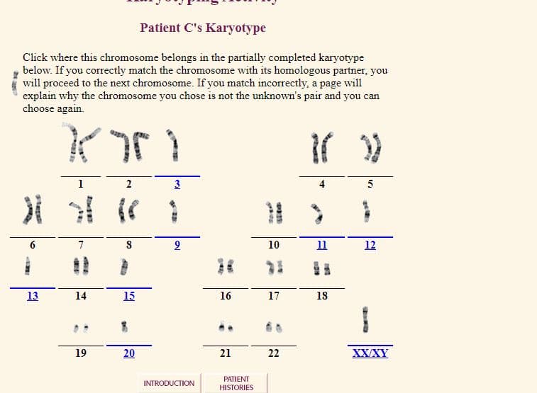 Patient C's Karyotype
Click where this chromosome belongs in the partially completed karyotype
below. If you correctly match the chromosome with its homologous partner, you
will proceed to the next chromosome. If you match incorrectly, a page will
explain why the chromosome you chose is not the unknown's pair and you can
choose again.
1
3
5
7
2
10
11
12
13
14
15
16
17
18
19
20
21
22
XX/XY
PATIENT
HISTORIES
INTRODUCTION
2.
