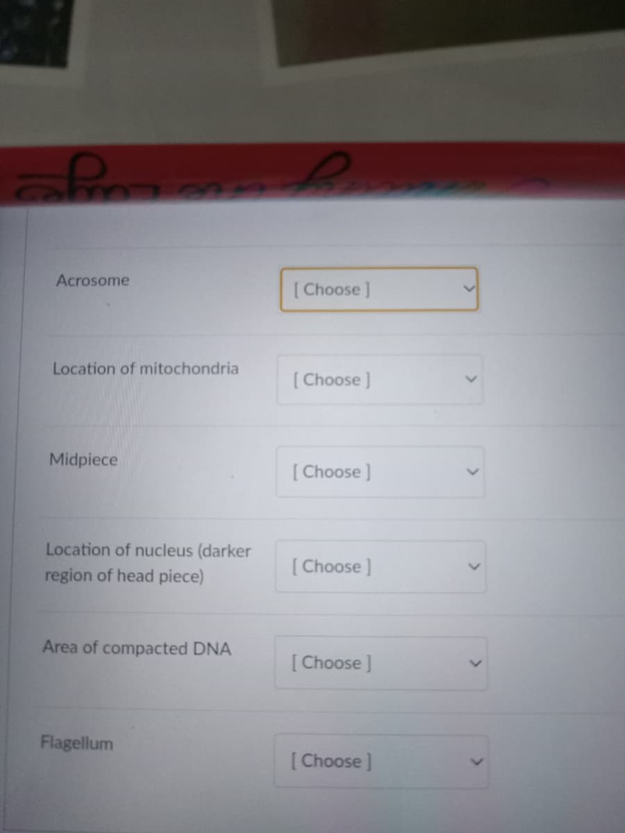 Acrosome
Location of mitochondria
Midpiece
Location of nucleus (darker
region of head piece)
Area of compacted DNA
Flagellum
[Choose ]
[Choose ]
[Choose ]
[Choose ]
[Choose ]
[Choose ]