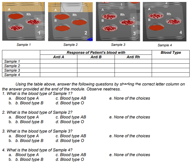 A
Rh
Rh
Rh
Rh
B
Sample 1
Sample 2
Sample 3
Sample 4
Blood Type
Response of Patient's blood with
Anti B
Anti A
Anti Rh
Sample 1
Sample 2
Sample 3
Sample 4
Using the table above, answer the following questions by shadling the correct letter column on
the answer provided at the end of the module. Observe neatness.
1. What is the blood type of Sample 1?
а. Blood type A
b. b. Blood type B
c. Blood type AB
d. Blood type O
e. None of the choices
2. What is the blood type of Sample 2?
a. Blood type A
b. b. Blood type B
c. Blood type AB
d. Blood type O
e. None of the choices
3. What is the blood type of Sample 3?
а. Blood type А
b. b. Blood type B
c. Blood type AB
d. Blood type O
e. None of the choices
4. What is the blood type of Sample 4?
a. Blood type A
b. b. Blood type
c. Blood type AB
d. Blood type O
e. None of the choices
