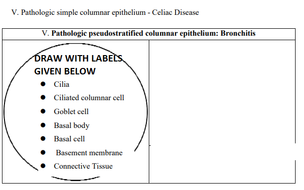 V. Pathologic simple columnar epithelium - Celiac Disease
V. Pathologic pseudostratified columnar epithelium: Bronchitis
DRAW WITH LABELS
GIVEN BELOW
● Cilia
• Ciliated columnar cell
●
Goblet cell
•
Basal body
● Basal cell
Basement membrane
Connective Tissue