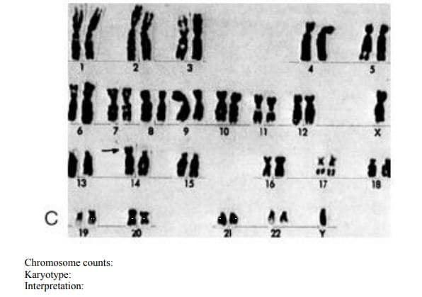 10
12
13
15
17
18
C
22
Chromosome counts:
Karyotype:
Interpretation:
