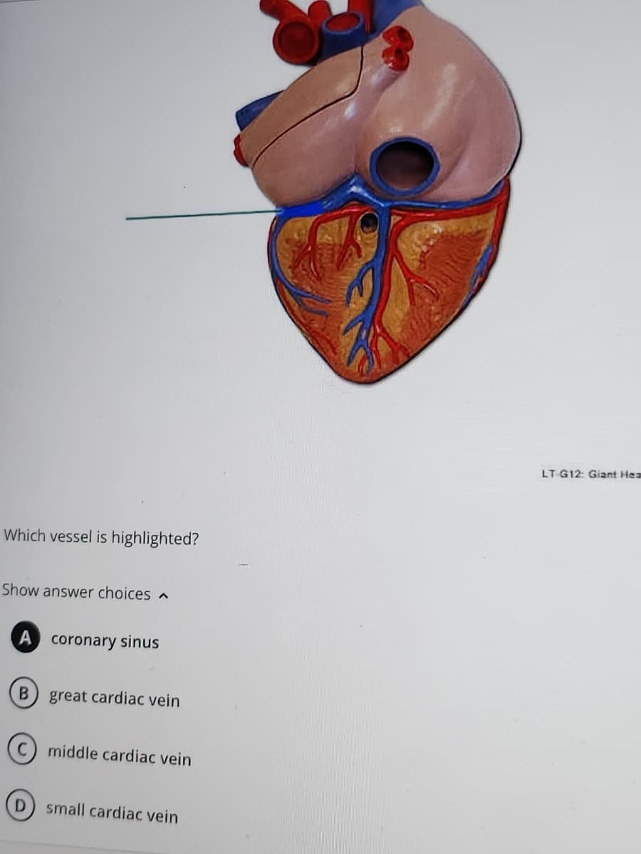 Which vessel is highlighted?
Show answer choices
A coronary sinus
B
great cardiac vein
Cmiddle cardiac vein
D
small cardiac vein
LT G12: Giant Hea