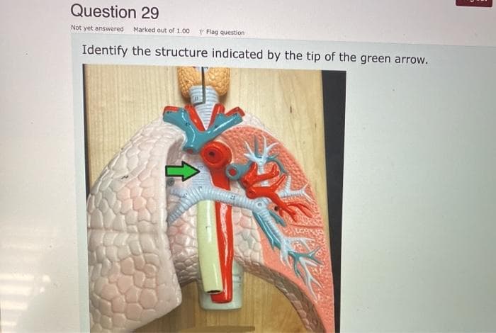 Question 29
Not yet answered
Marked out of 1.00
P Flag question
Identify the structure indicated by the tip of the green arrow..
