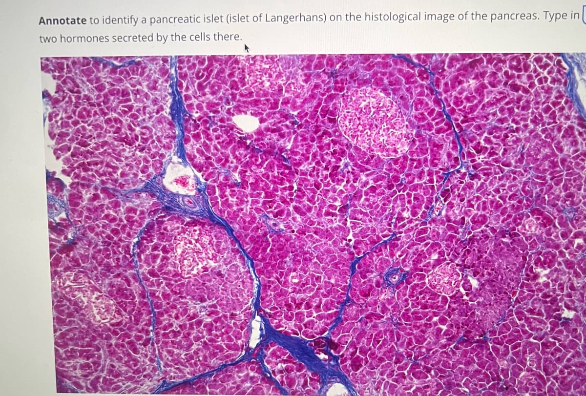 Annotate to identify a pancreatic islet (islet of Langerhans) on the histological image of the pancreas. Type in
two hormones secreted by the cells there.