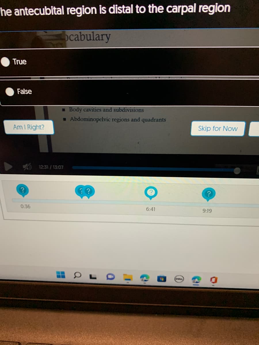 he antecubital region is distal to the carpal region
ocabulary
True
False
Am I Right?
?
0:36
■ Body cavities and subdivisions
■ Abdominopelvic regions and quadrants
12:31/13:07
??
a
J
a
1
6:41
DELL
Skip for Now
9:19