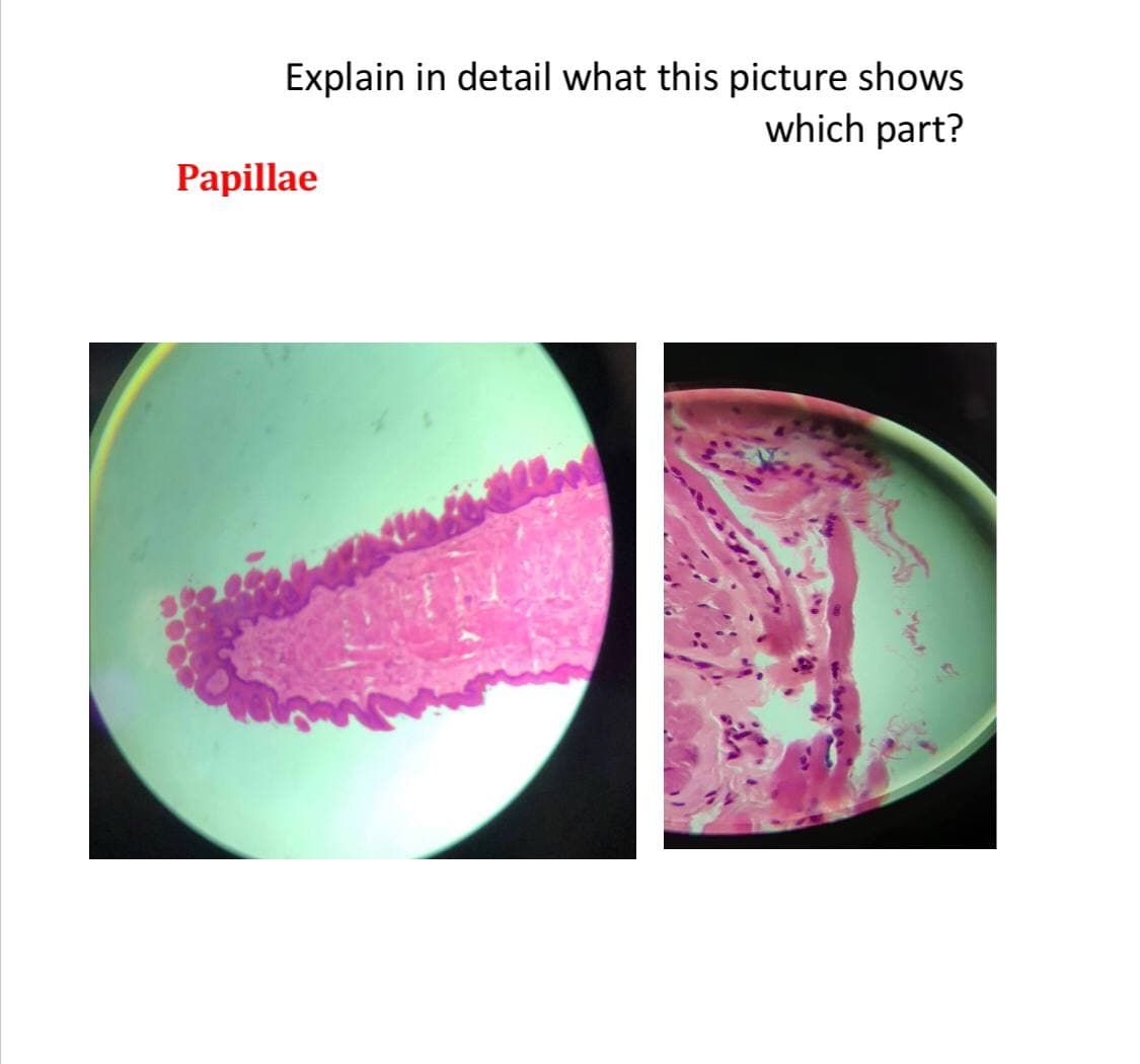 Explain in detail what this picture shows
which part?
Papillae
