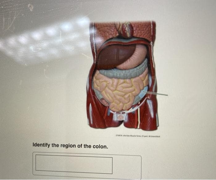 www
Identify the region of the colon.
