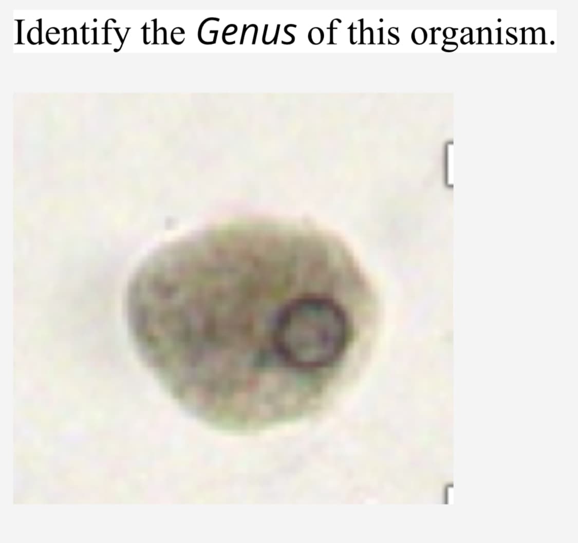Identify the Genus of this organism.
