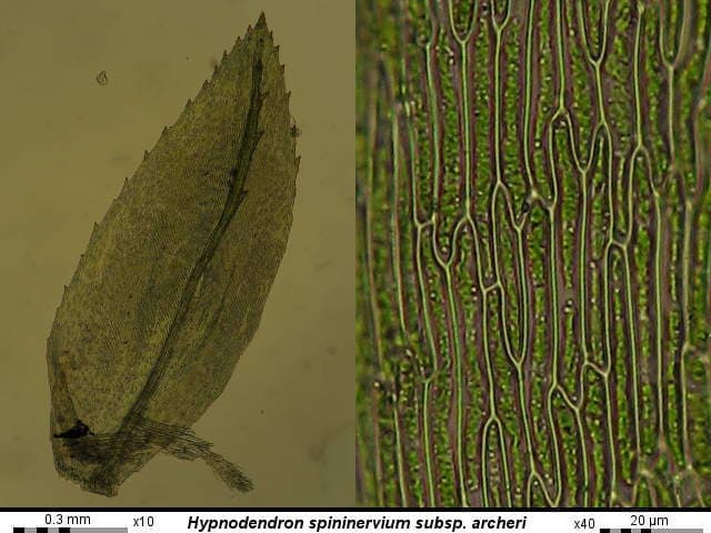 x40
20 um
0.3 mm
Hypnodendron spininervium subsp. archeri
х10
