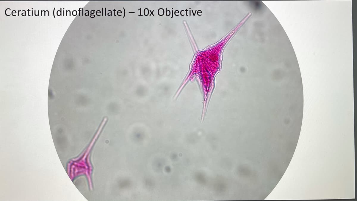 Ceratium (dinoflagellate) - 10x Objective
