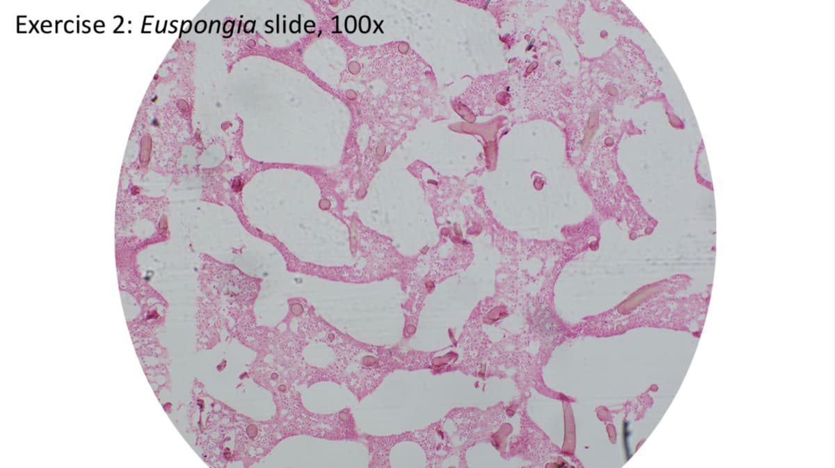 Exercise 2: Euspongia slide, 100x
