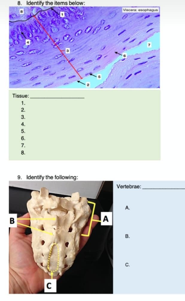 8. Identify the items below:
Viscera: esophagus
Tissue:
1.
2.
3.
4.
5.
6.
7.
8.
9. Identify the following:
Vertebrae:
A.
В
A
В.
С.
