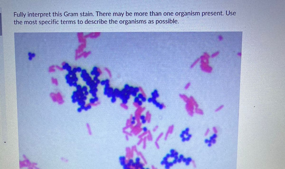 Fully interpret this Gram stain. There may be more than one organism present. Use
the most specific terms to describe the organisms as possible.
