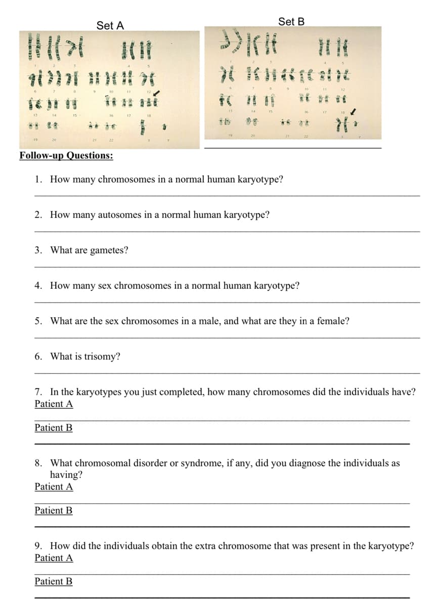 Set A
Set B
i》}| 汁
清 t
13
...
Follow-up Questions:
1. How many chromosomes in a normal human karyotype?
2. How many autosomes in a normal human karyotype?
3. What are gametes?
4. How many sex chromosomes in a normal human karyotype?
5. What are the sex chromosomes in a male, and what are they in a female?
6. What is trisomy?
7. In the karyotypes you just completed, how many chromosomes did the individuals have?
Patient A
Patient B
8. What chromosomal disorder or syndrome, if any, did you diagnose the individuals as
having?
Patient A
Patient B
9. How did the individuals obtain the extra chromosome that was present in the karyotype?
Patient A
Patient B

