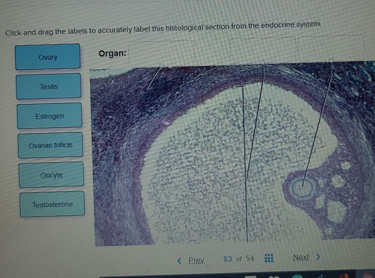 Click and drag the labels to accurately label this histological section from the endocrine system.
Ovary
Organ:
Testis
Estrogen
Ovarian follicie
Oocyte
Testosterone
< Prev
53 of 54
Next >
