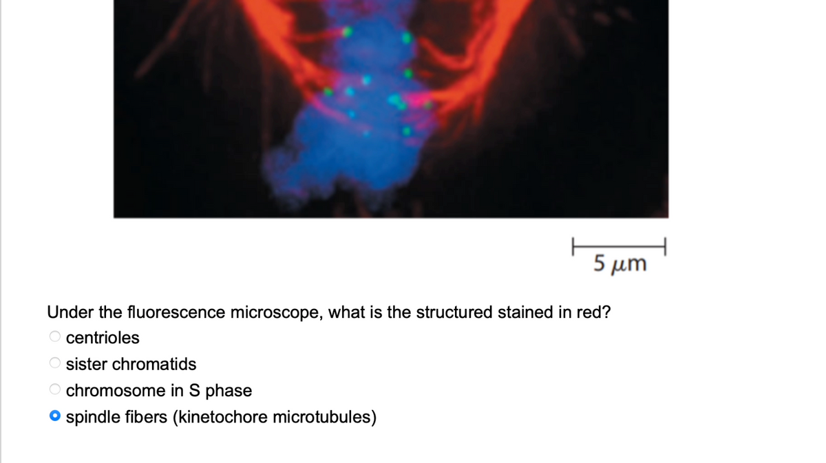 5 μm
Under the fluorescence microscope, what is the structured stained in red?
centrioles
sister chromatids
оо
chromosome in S phase
spindle fibers (kinetochore microtubules)