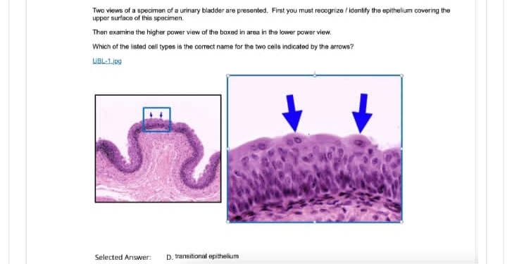 Two views of a specimen of a urinary bladder are presented. First you must recognize / identify the epithelium covering the
upper surface of this specimen.
Then examine the higher power view of the boxed in area in the lower power view.
Which of the listed cell types is the correct name for the two cells indicated by the arrows?
UBL-1.jpg
Selected Answer: D. transitional epithelium