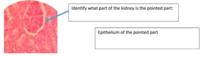 Identify what part of the kidney is the pointed part:
Epithelium of the pointed part
