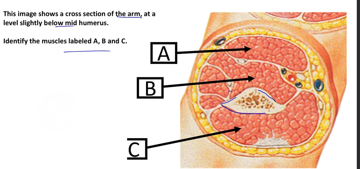 This image shows a cross section of the arm, at a
level slightly below mid humerus.
Identify the muscles labeled A, B and C.
A
B
CH