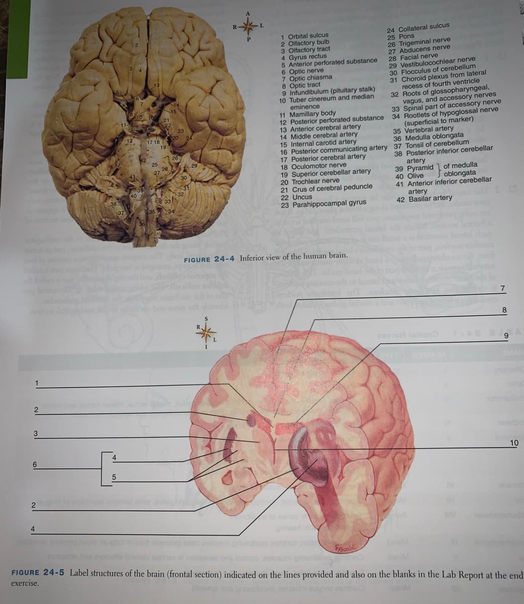 R
24 Collateral sulcus
25 Pons
26 Trigeminal nerve
27 Abducens nerve
28 Facial nerve
29 Vestibulocochlear nerve
30 Flocculus of cerebellum
31 Choroid plexus from lateral
recess of fourth ventricle
32 Roots of glossopharyngeal,
vagus, and accessory nerves
33 Spinal part of accessory nerve
1 Orbital sulcus
2 Olfactory bulb
3 Olfactory tract
4 Gyrus rectus
5 Anterior perforated substance
6 Optic nerve
7 Optic chiasma
8 Optic tract
9 Infundibulum (pituitary stalk)
10 Tuber cinereum and median
eminence
11 Mamillary body
12 Posterior perforated substance 34 Rootlets of hypoglossal nerve
13 Anterior cerebral artery
14 Middle cerebral artery
15 Internal carotid artery
16 Posterior communicating artery 37 Tonsil of cerebellum
17 Posterior cerebral artery
18 Oculomotor nerve
19 Superior cerebellar artery
20 Trochlear nerve
21 Crus of cerebral peduncle
22 Uncus
23 Parahippocampal gyrus
15
10
23
(superficial to marker)
35 Vertebral artery
36 Medulla oblongata
12
20
17 18
19
38 Posterior inferior cerebellar
artery
39 Pyramid 1 of medulla
40 Olive
41 Anterior inferior cerebellar
artery
42 Basilar artery
25
26.
27
30
J oblongata
40
32
V 33
35
FIGURE 24-4 Inferior view of the human brain.
8.
1
2
3
10
2
eow oh
4
Spala
FIGURE 24-5 Label structures of the brain (frontal section) indicated on the lines provided and also on the blanks in the Lab Report at the end
beM
exercise.
