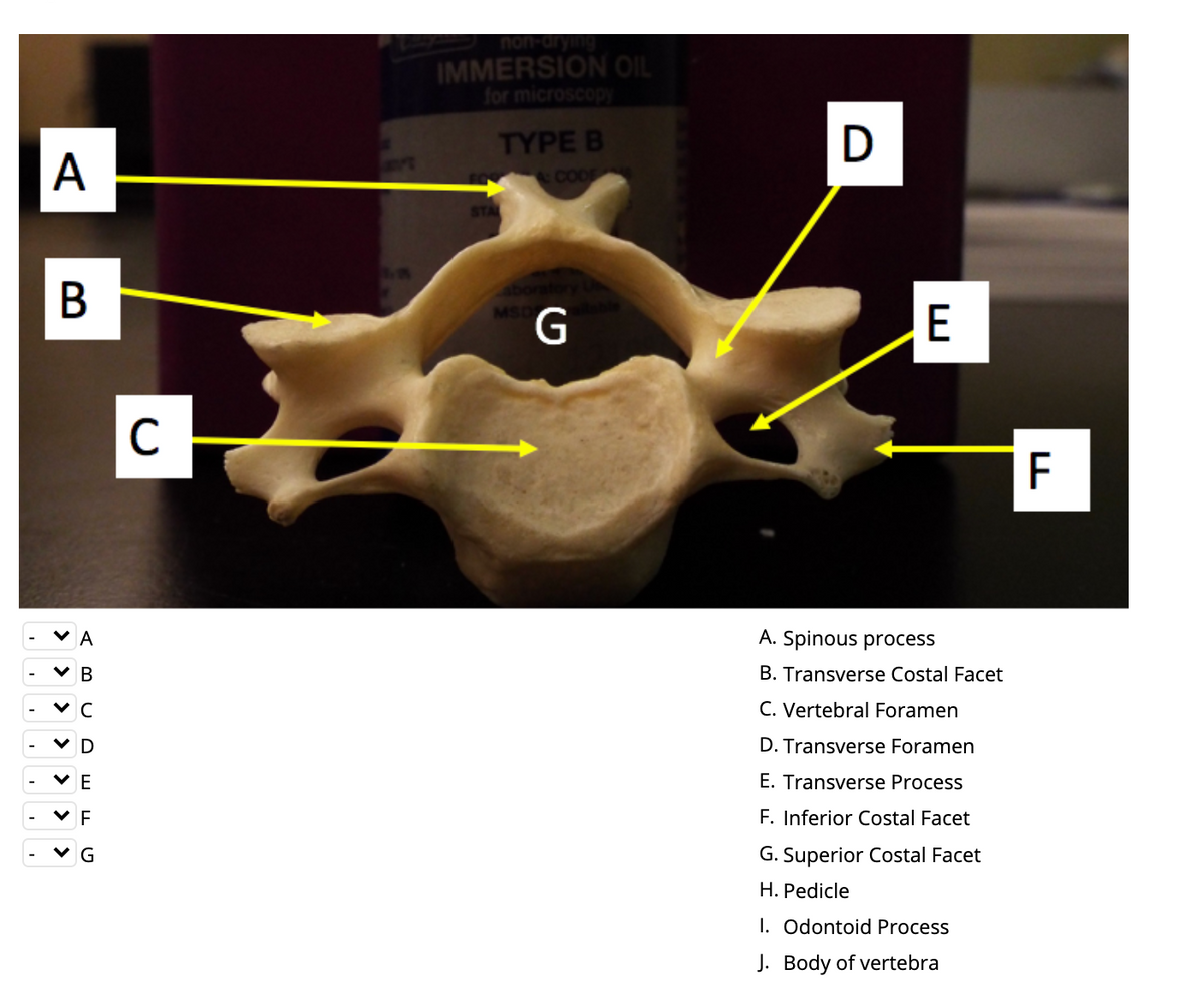 IMMERSION OIL
for microscopy
TYPE B
A
&CODE
F
A
A. Spinous process
V B
B. Transverse Costal Facet
C. Vertebral Foramen
V D
D. Transverse Foramen
V E
E. Transverse Process
V E
F. Inferior Costal Facet
G
G. Superior Costal Facet
H. Pedicle
I. Odontoid Process
J. Body of vertebra
