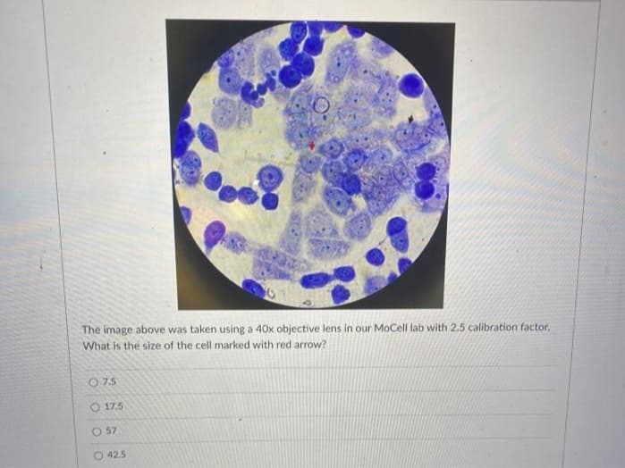 The image above was taken using a 40x objective lens in our MoCell lab with 2.5 calibration factor.
What is the size of the cell marked with red arrow?
07.5
17.5
O 57
O42.5