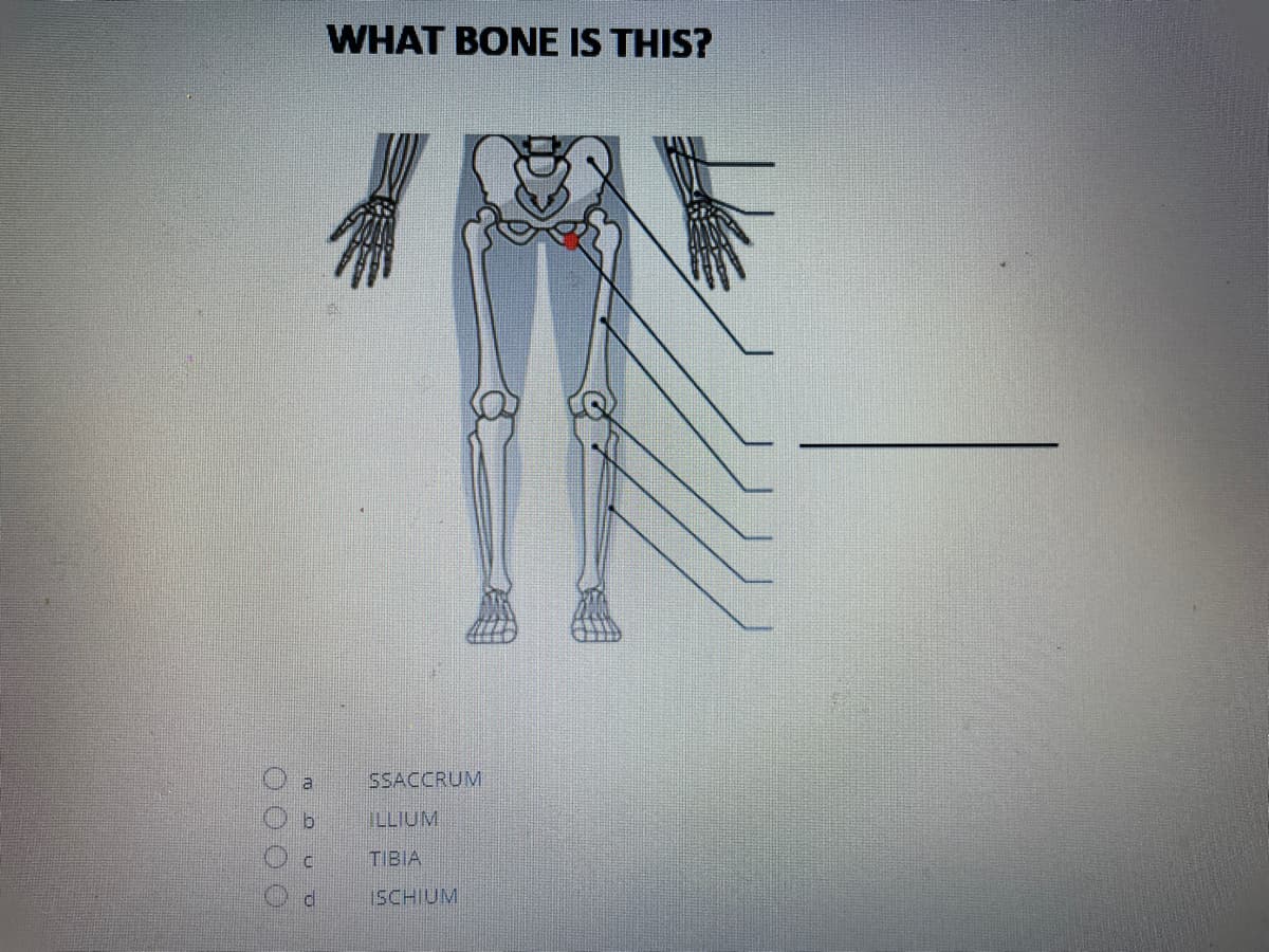 WHAT BONE IS THIS?
a
SSACCRUM
ILLIUM
TIBIA
ISCHIUM
