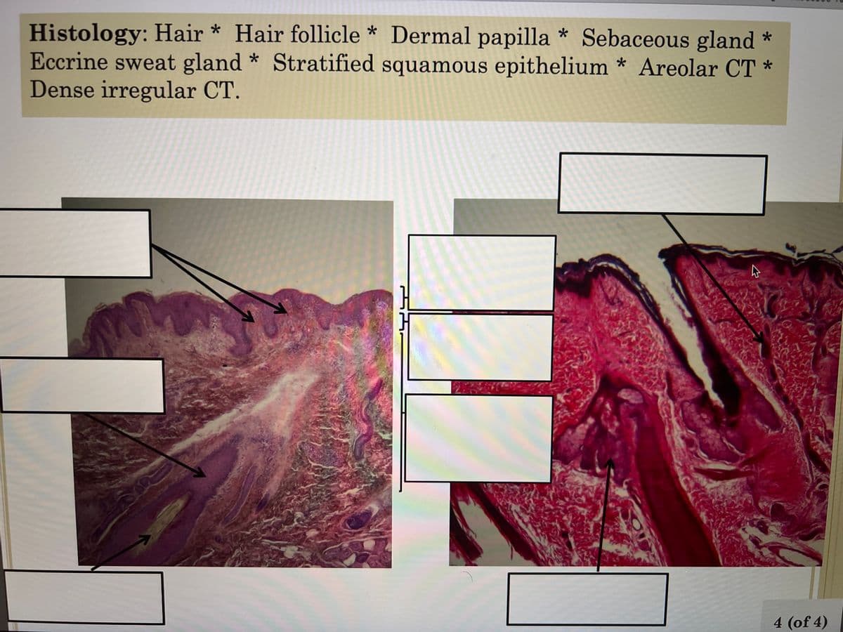 Histology: Hair * Hair follicle * Dermal papilla * Sebaceous gland *
Eccrine sweat gland * Stratified squamous epithelium* Areolar CT *
Dense irregular CT.
4
4 (of 4)