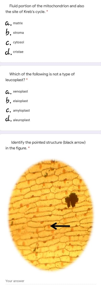 Fluid portion of the mitochondrion and also
the site of Kreb's cycle. *
a, matrix
b.
stroma
С, сytosol
d.
cristae
Which of the following is not a type of
leucoplast? *
a, xenoplast
b. elaioplast
C. amyloplast
d.
aleuroplast
Identify the pointed structure (black arrow)
in the figure. *
Your answer
