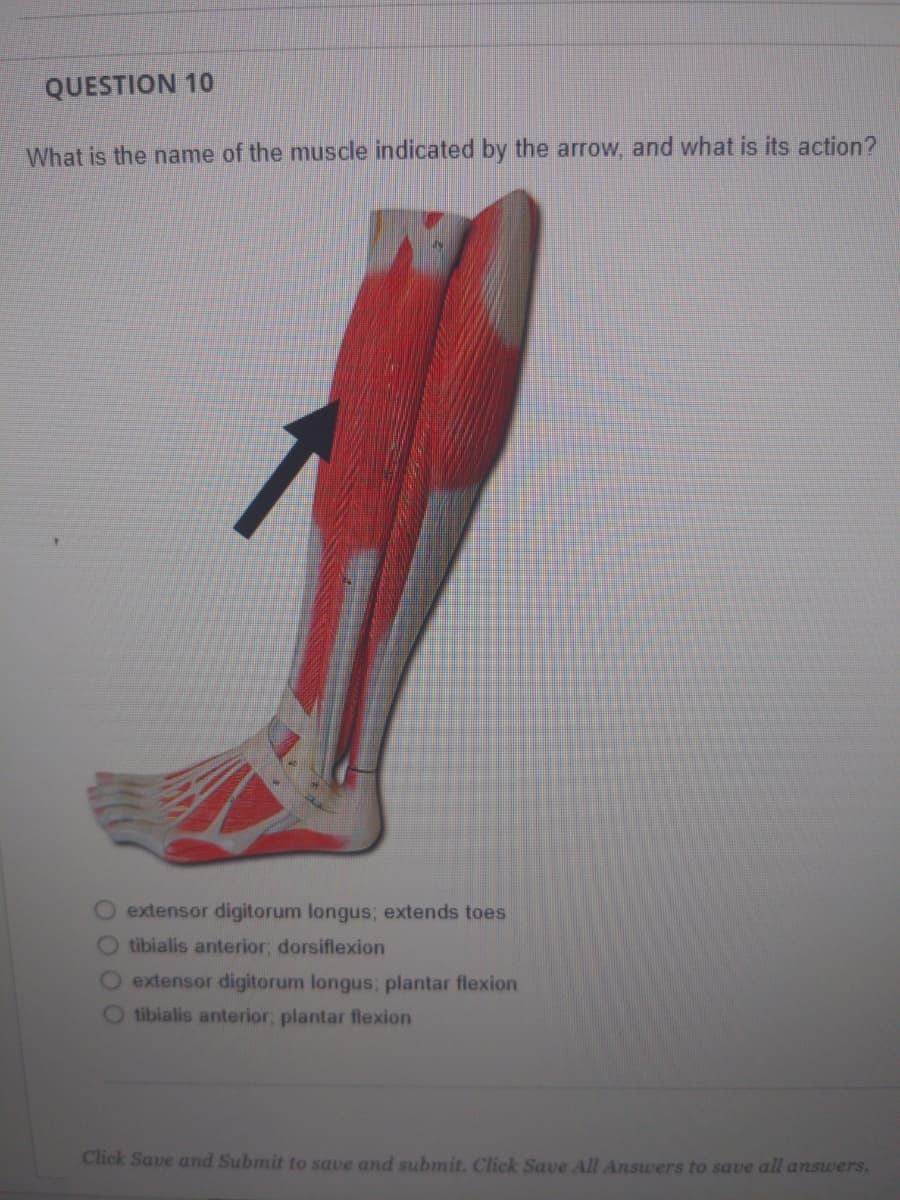 QUESTION 10
What is the name of the muscle indicated by the arrow, and what is its action?
extensor digitorum longus; extends toes
O tibialis anterior, dorsiflexion
O extensor digitorum longus; plantar flexion
O tibialis anterior, plantar flexion
Click Save and Submit to save and submit. Click Save All Answers to save all answers.
