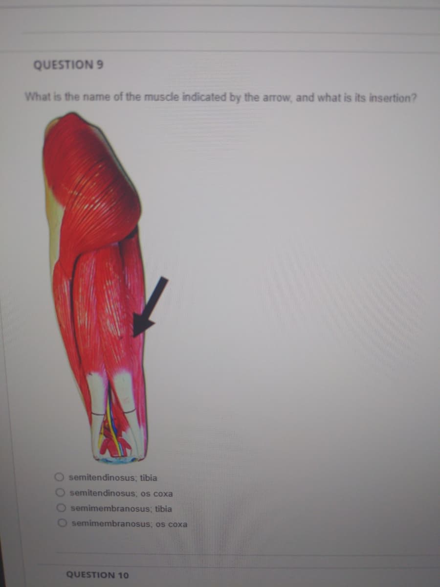 QUESTION 9
What is the name of the muscle indicated by the arrow, and what is its insertion?
O semitendinosus; tibia
O semitendinosus; os coxa
O semimembranosus; tibia
O semimembranosus; os coxa
QUESTION 10
