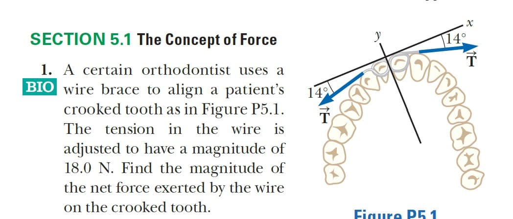 SECTION 5.1 The Concept of Force
|14°
1. A certain orthodontist uses a
BIO wire brace to align a patient's
crooked tooth as in Figure P5.1.
14
The tension in the wire is
adjusted to have a magnitude of
18.0 N. Find the magnitude of
the net force exerted by the wire
on the crooked tooth.
Figure P51
