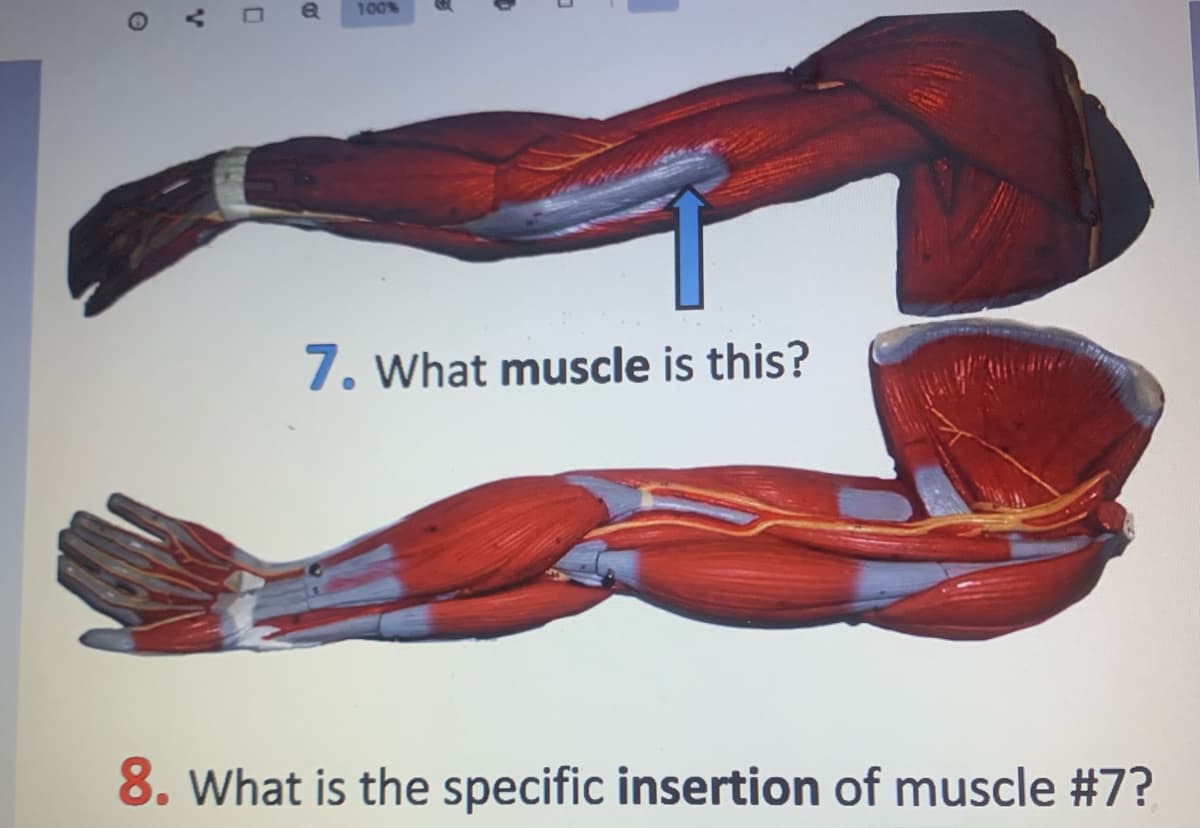 V
0
B
100%
0
7. What muscle is this?
by till de
8. What is the specific insertion of muscle #7?
